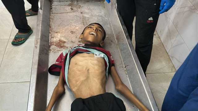 الحكومي بغزة: 122 شهيداً بسبب المجاعة في قطاع غزة بينهم 83 طفلاً