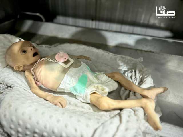الصحة بغزة: 5 وفيات جديدة بسبب المجاعة وسوء التغذية خلال 24 ساعة