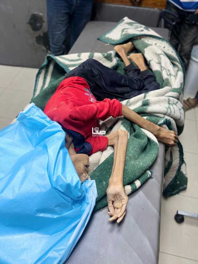 'أونروا': أهالي غزة يموتون وموظفونا يُغمى عليهم من شدة الجوع
