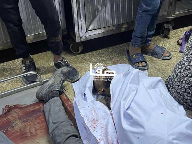 31 شهيدًا ومصابون في قصف إسرائيلي على قطاع غزة
