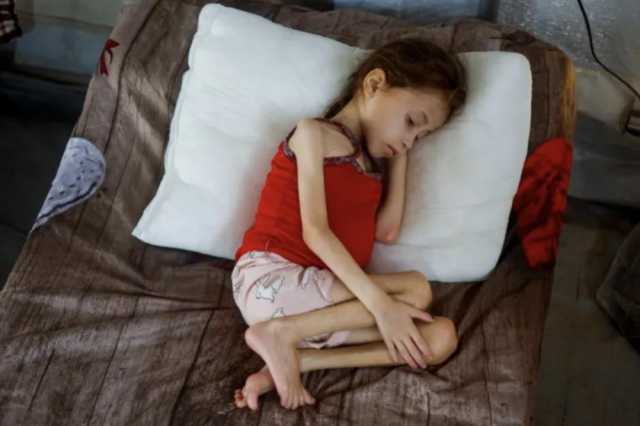 مقرر أممي: تجويع 'إسرائيل' لغزة جريمة حرب