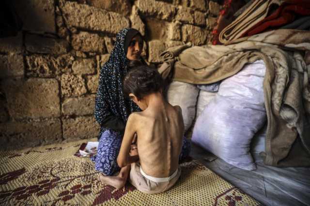 مجلة طبية: سكان غزة يواجهون تهديد أمراض مقاومة للمضادات الحيوية