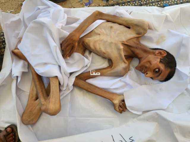 يرفع العدد لـ162.. الصحة: 3 وفيات جديدة بغزة بسوء التغذية والمجاعة خلال 24 ساعة
