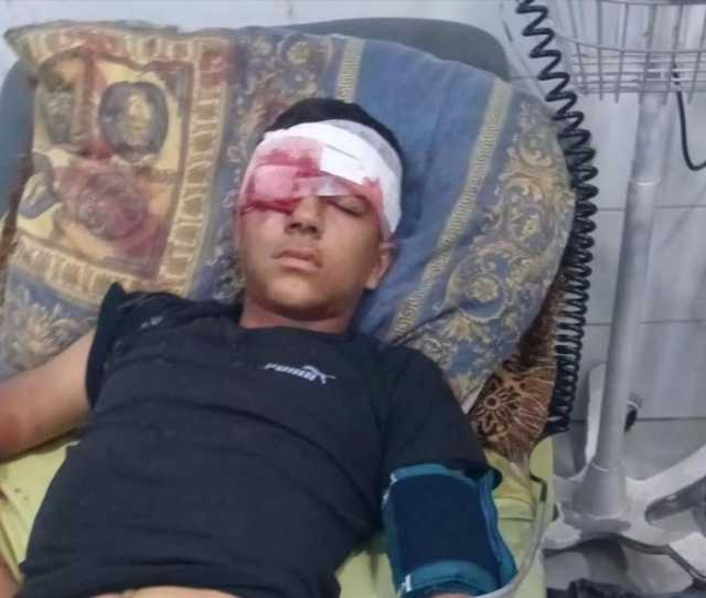 إصابة طفل جراح خطيرة باقتحام الاحتلال بلدة بيت عوا بالخليل