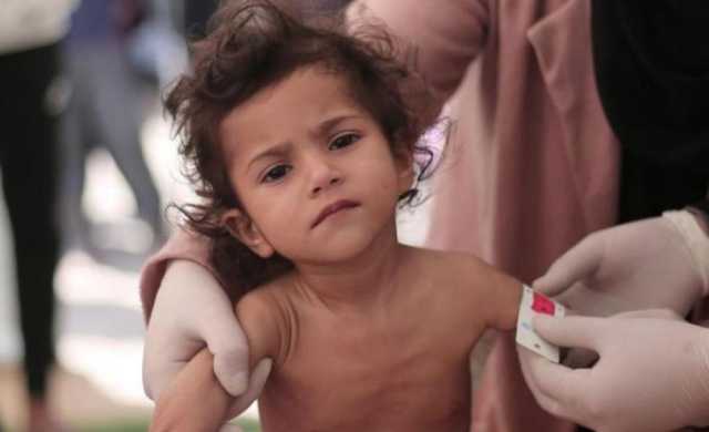 رابط التسجيل في برنامج سوء التغذية غزة.. مجلس كنائس الشرق الاوسط