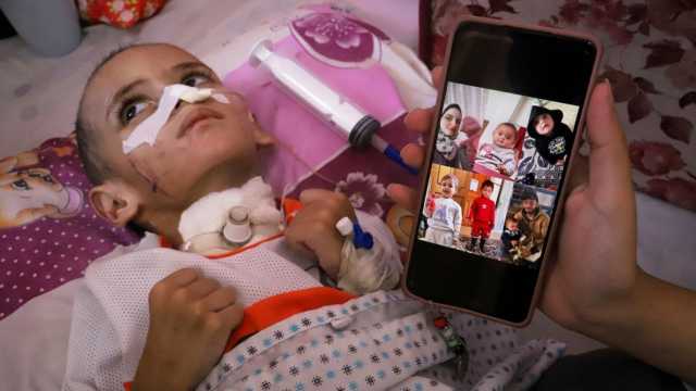 جسد صغير مثقل بالحرب.. طفل مصاب بتلف دماغي في غزة يُصارع للبقاء