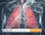 الكشف عن سر مذهل لتنظيف الرئتين من آثار التدخين سريعا