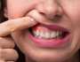 احذر بشدة.. إصابة اللثة قد يكون علامة على الإصابة بأمراض مميتة