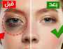 وصفة طبيعية معجزة للقضاء على الهالات السوداء بلمح البصر.. آمنة وفعالة 100%