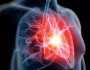 لماذا تنتشر السكتة القلبية لدى الشباب؟