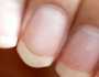 «لو عاوزة تخليهم بيلمعوا».. أسرع طريقة لتنظيف الأظافر في المنزل