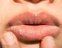5 نصائح لعلاج اسمرار الشفاه.. توقفي عن هذه العادات الخاطئة