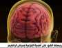 أحد أشكال الخرف شيوعا.. ألزهايمر يؤثر على ملايين الأشخاص بالعالم
