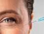5 فئات ممنوعة من حقن البوتكس.. تحذير لجميع الفتيات