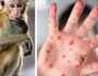 بعد وصوله أمريكا.. أعراض جدرى القرود وطرق الوقاية منه