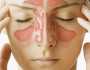 لمرضى الجيوب الأنفية.. 5 نصائح للتغلب على «صداع الالتهابات»