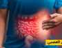 لعلاج القولون العصبي دون مسكنات.. 6 مشروبات عليك تناولها؟