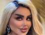 داليا نعيم تتصدر الصحف العالمية بسبب عمليات التجميل