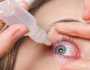 علاجات منزلية فعالة للتخلص من جفاف العين وتحسين الترطيب