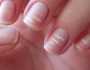 أسباب ظهور بقع بيضاء على الأظافر
