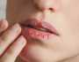 علامات في الشفاه تنبئ بمخاطر صحية محتملة