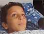 طفل فلسطيني يناشد لعلاجه في مصر بدلا من بتر ساقه شاهد