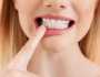 ودع آلام الأسنان .. 8 خطوات لتخفيف الحساسية وتقليل الألم مرأة