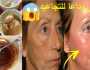 لو عمرك 50 سنه الزبادي والقرنفل سر اخفاء التجاعيد والترهلات وشد البشرة من اول مرة نتيجة سحرية اخبار اليوم