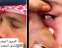 هل خبيرة أم ”ساحرة”؟.. عجوز حضرمية تثير الجدل بقدرات خارقة لإخراج ”الحصى من العيون” (فيديو)