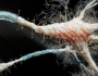 دراسة: ألزهايمر قد ينتقل عبر زرع الأعضاء