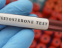 'الوباء الصامت'.. كيف يؤثر انخفاض التستوستيرون على حياة الرجال؟