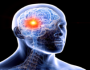 علامة شائعة لسرطان الدماغ 'غالبا ما يتجاهلها الناس'