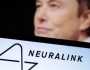 شركة ماسك تحصل على الموافقة لزرع رقاقة إلكترونية في الدماغ